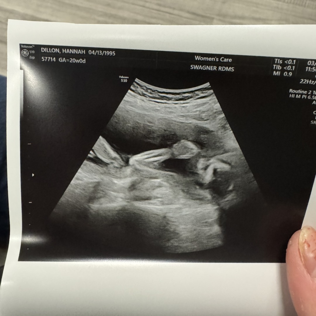 Photo shared by Tanim for their Babylist baby registry.