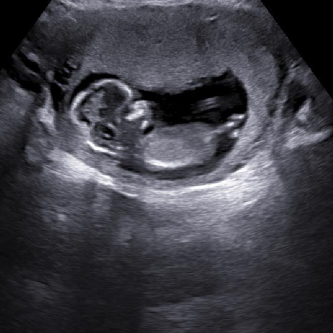 Photo shared by Lexi for their Babylist baby registry.