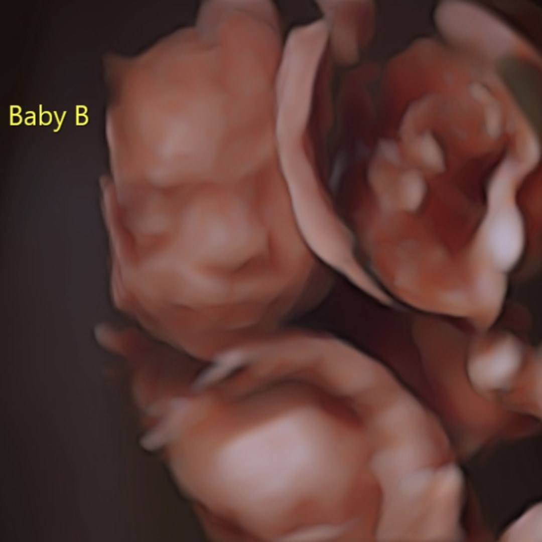 Photo shared by Kara for their Babylist baby registry.