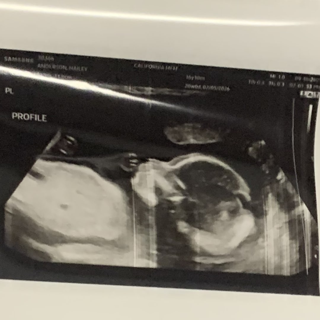 Photo shared by Hailey for their Babylist baby registry.