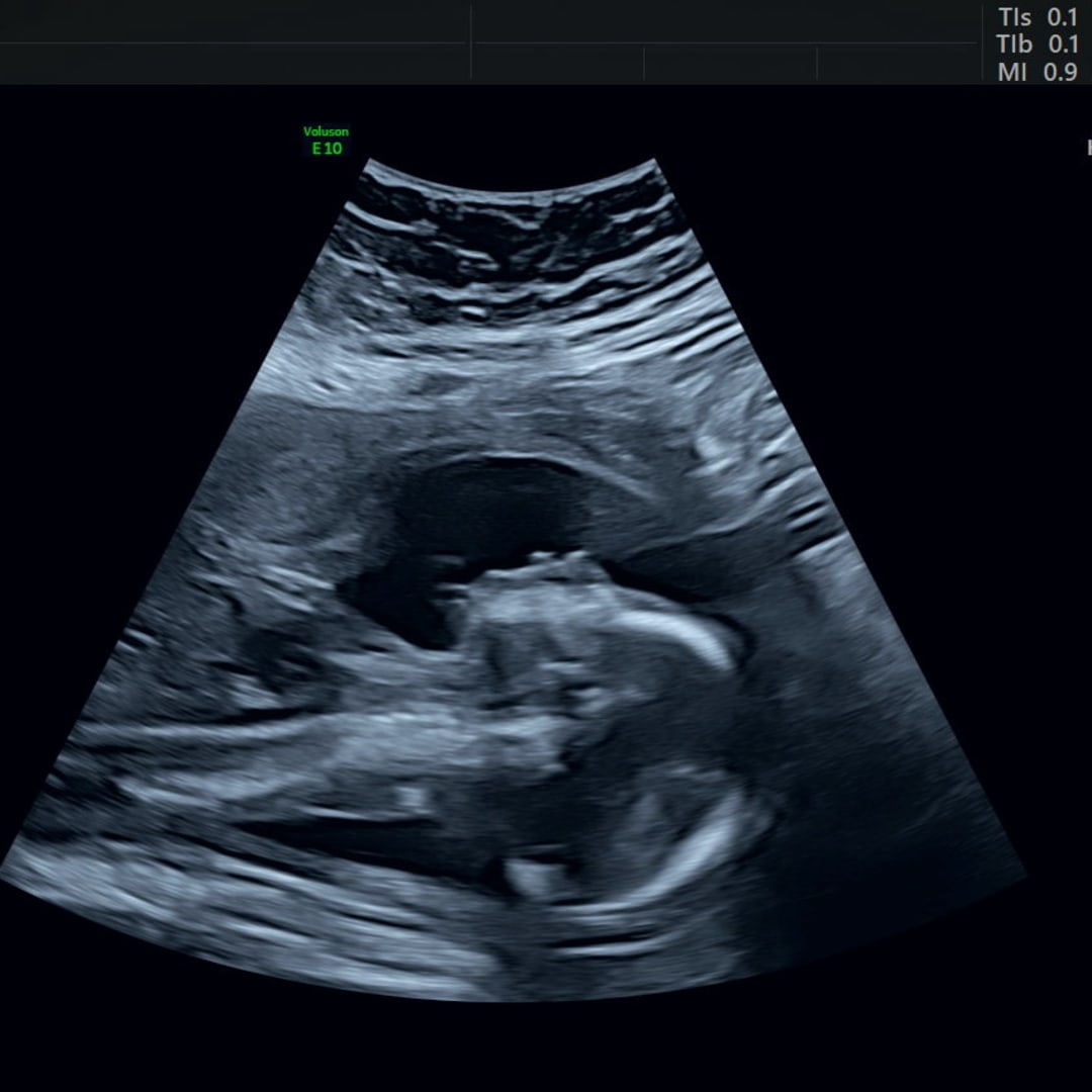 Photo shared by Emily for their Babylist baby registry.