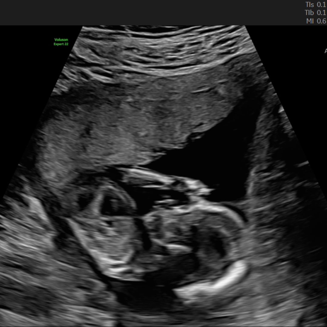 Photo shared by Mackenzie for their Babylist baby registry.