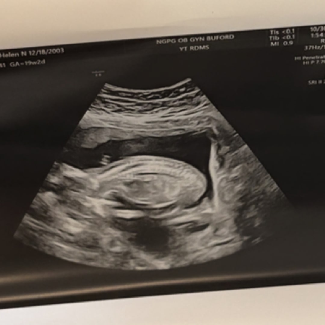 Photo shared by Helen for their Babylist baby registry.