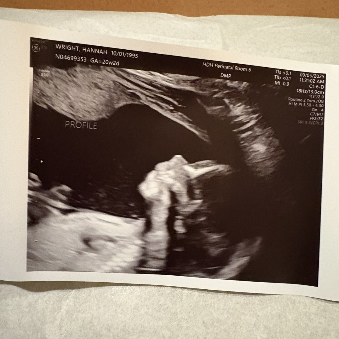 Photo shared by Hannah for their Babylist baby registry.