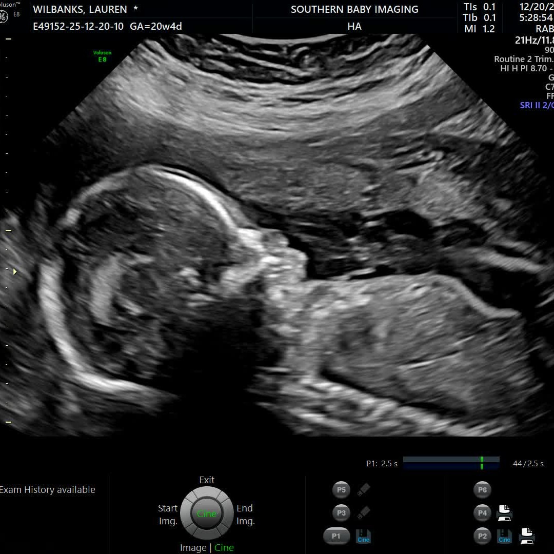 Photo shared by Lauren for their Babylist baby registry.