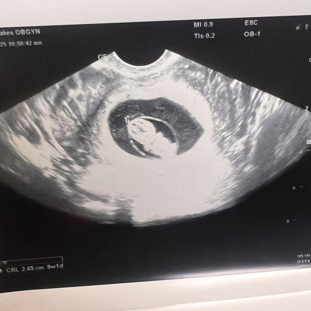 Photo shared by Tonia for their Babylist baby registry.