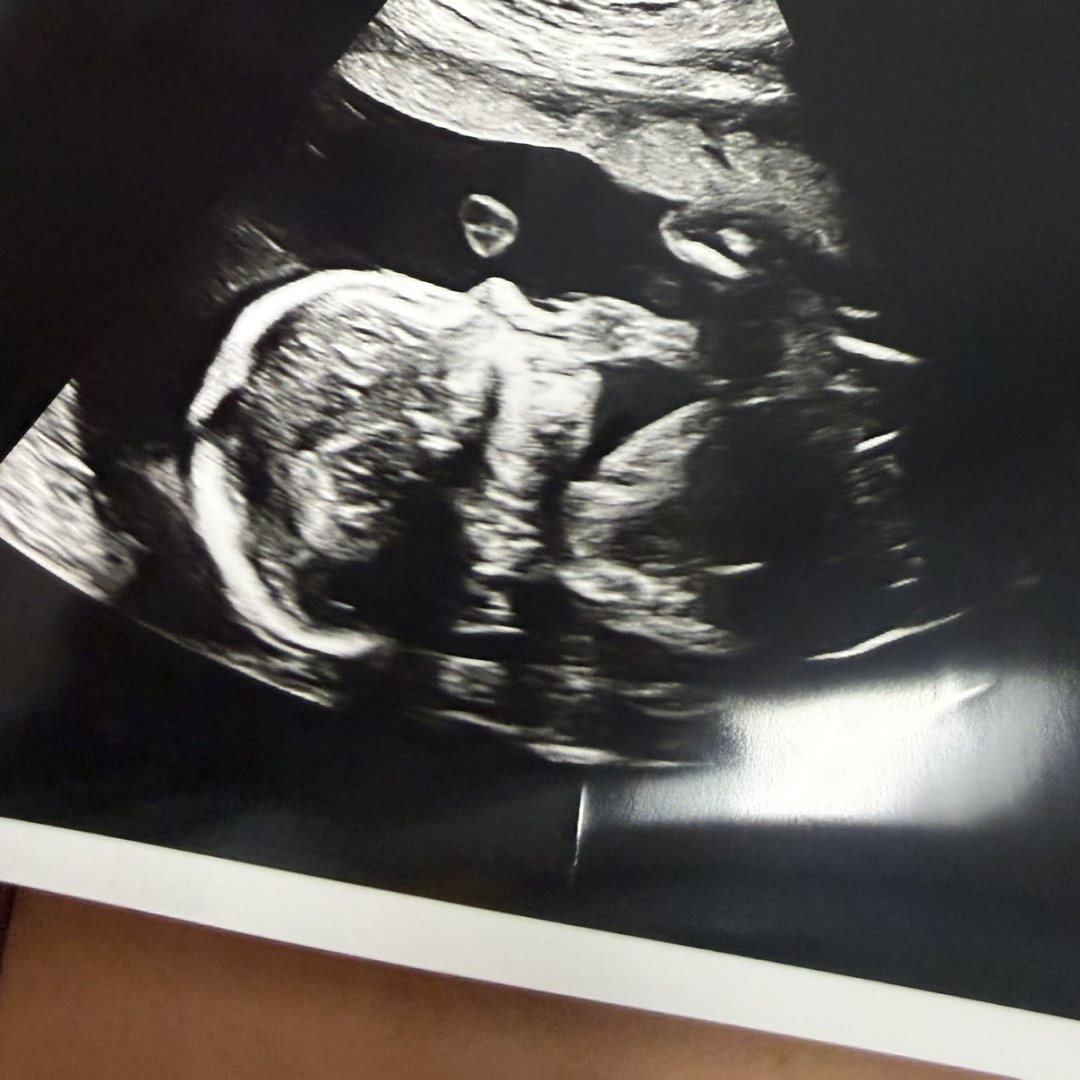 Photo shared by Lacey for their Babylist baby registry.