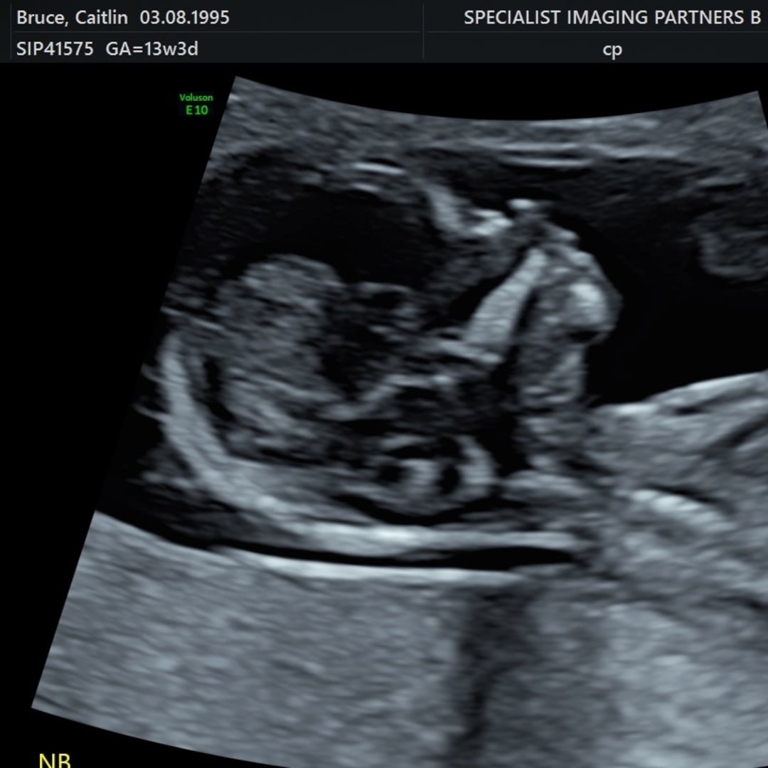 Photo shared by Caitlin for their Babylist baby registry.