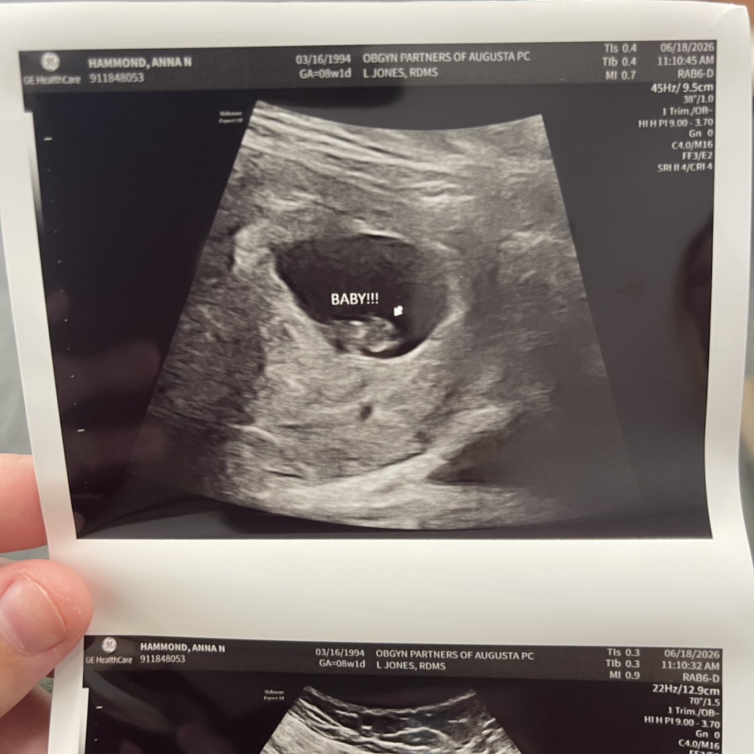 Photo shared by Anna for their Babylist baby registry.