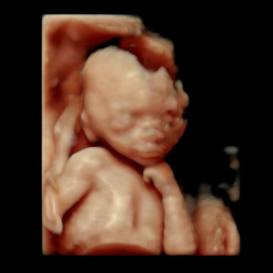 Photo shared by Hailey for their Babylist baby registry.