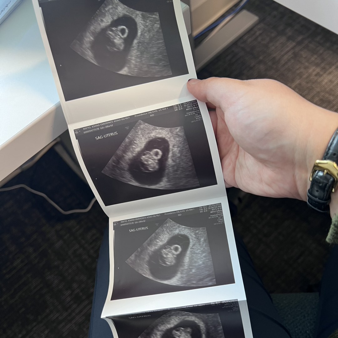 Photo shared by Joana for their Babylist baby registry.