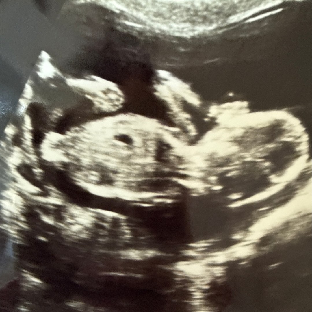 Photo shared by Brady for their Babylist baby registry.