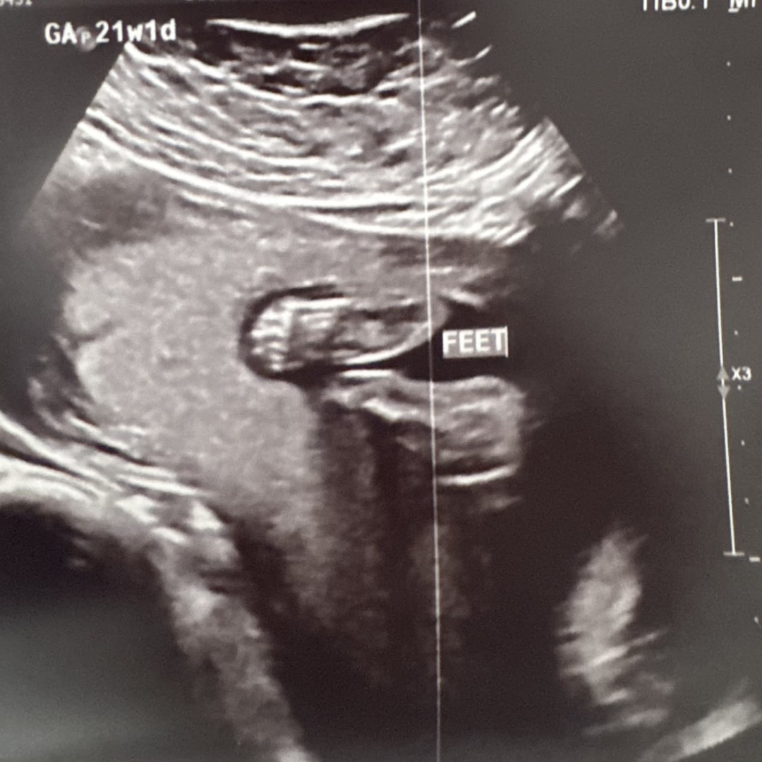 Photo shared by Mary for their Babylist baby registry.