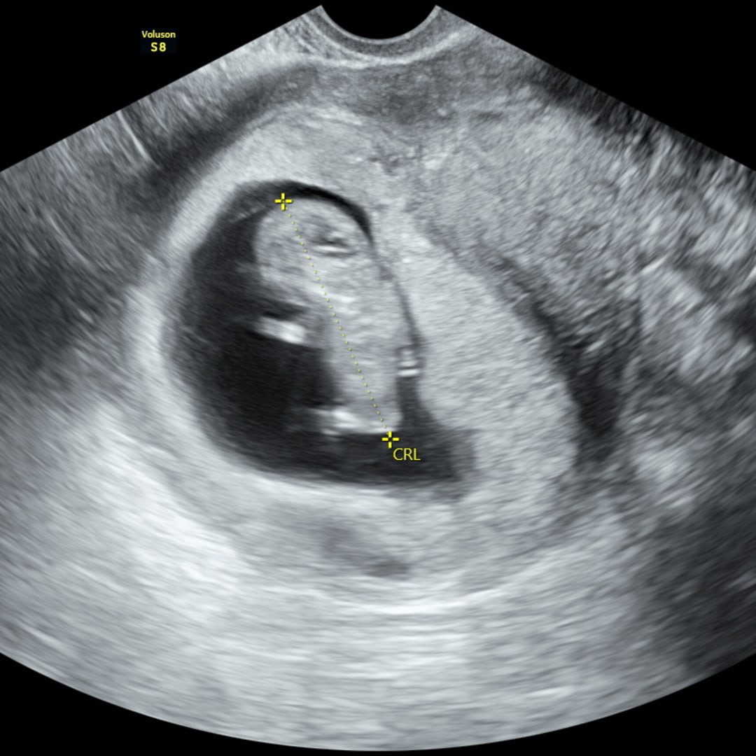 Photo shared by Mandy for their Babylist baby registry.