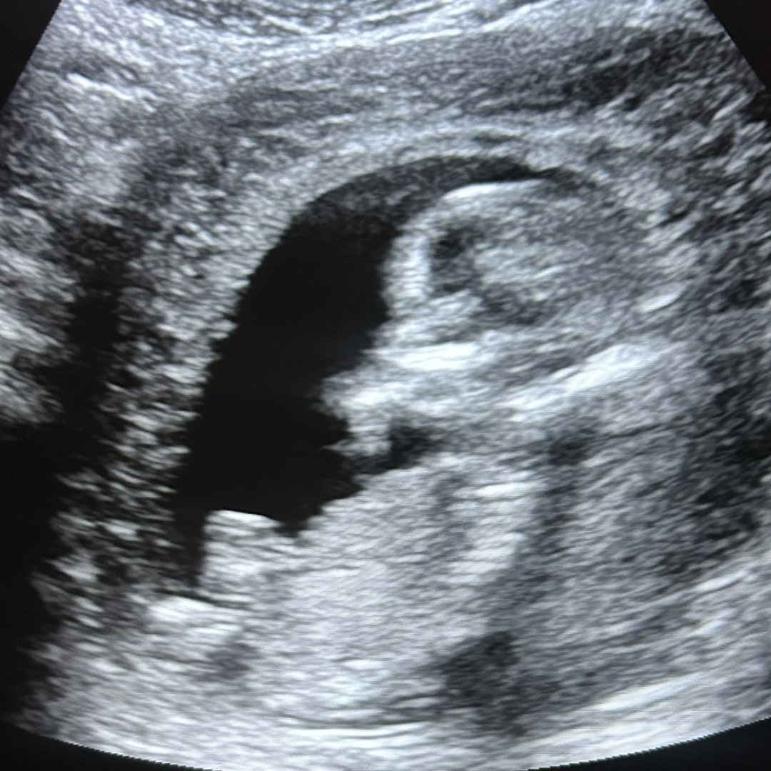 Photo shared by Marlena for their Babylist baby registry.