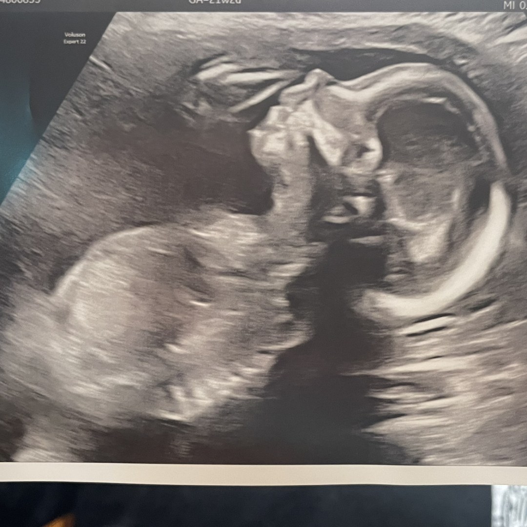 Photo shared by Annabel for their Babylist baby registry.