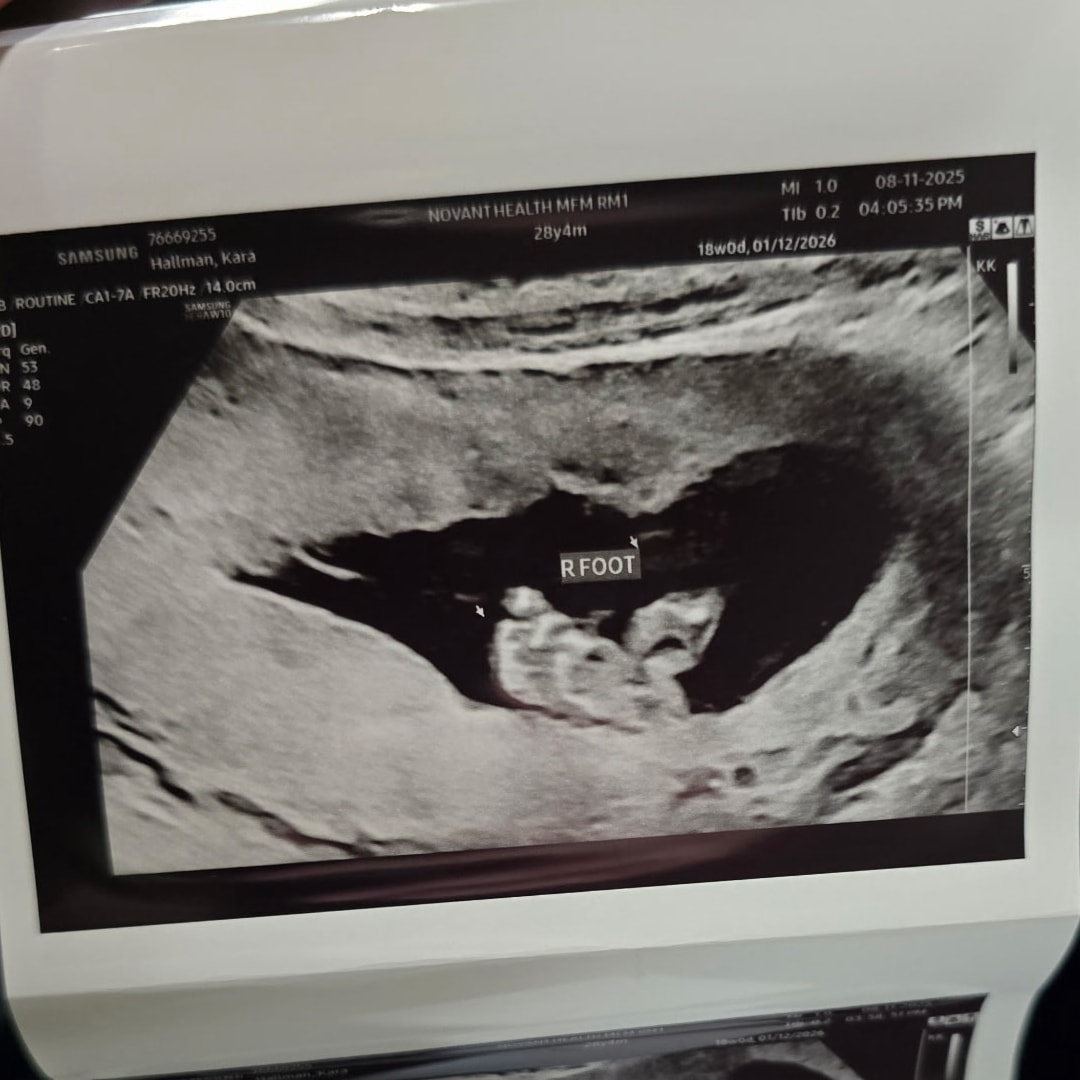 Photo shared by Kara for their Babylist baby registry.