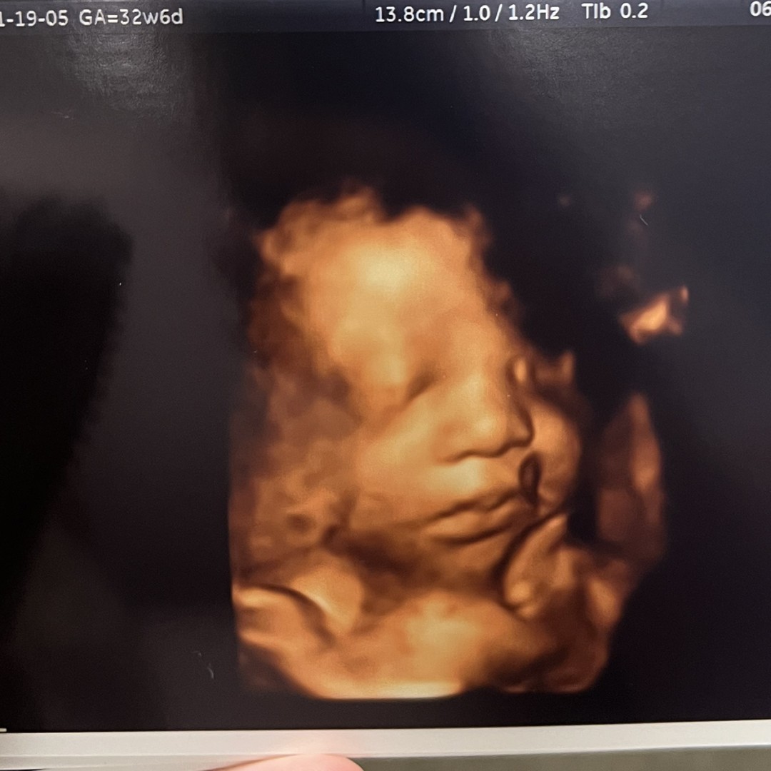 Photo shared by Jina for their Babylist baby registry.