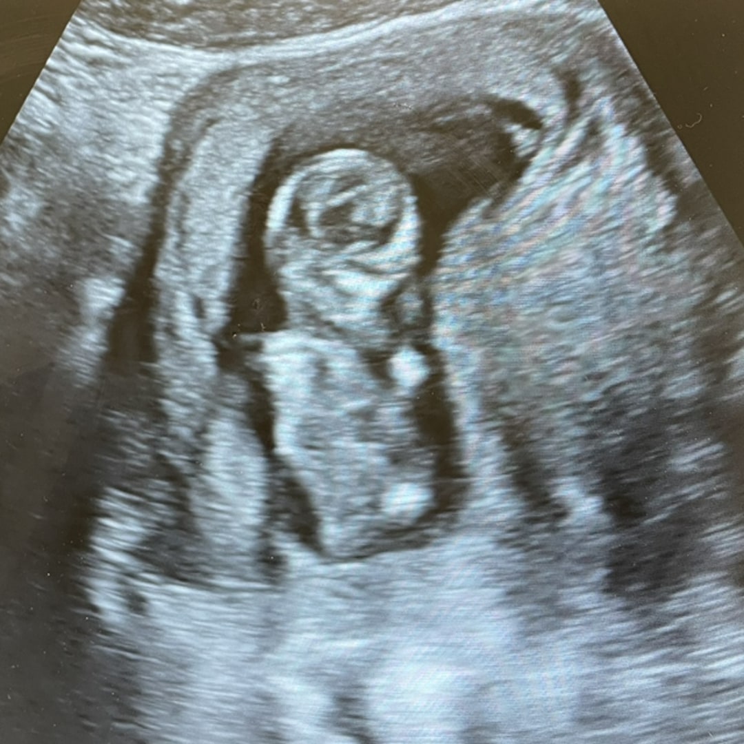 Photo shared by Martha for their Babylist baby registry.