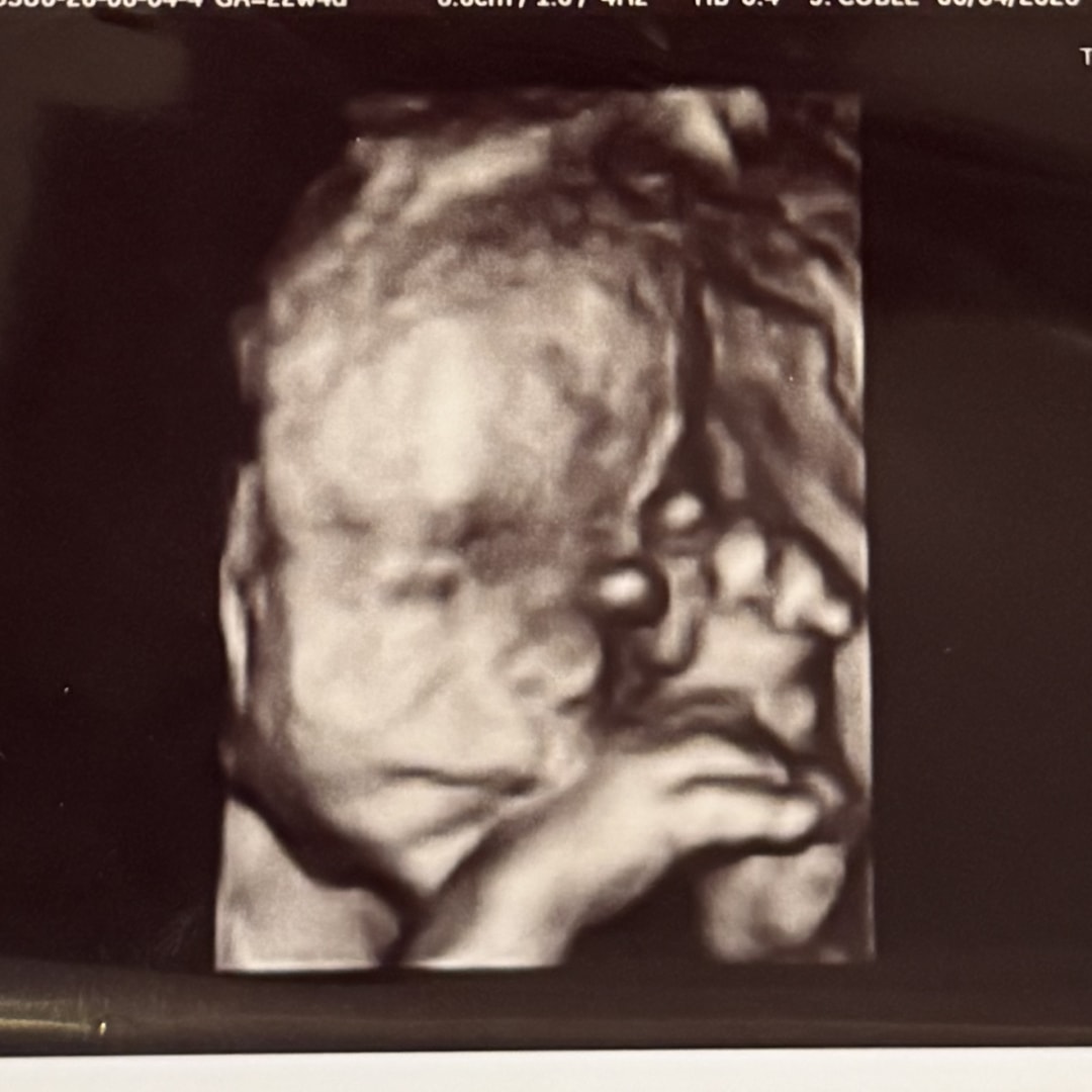 Photo shared by Amiee for their Babylist baby registry.