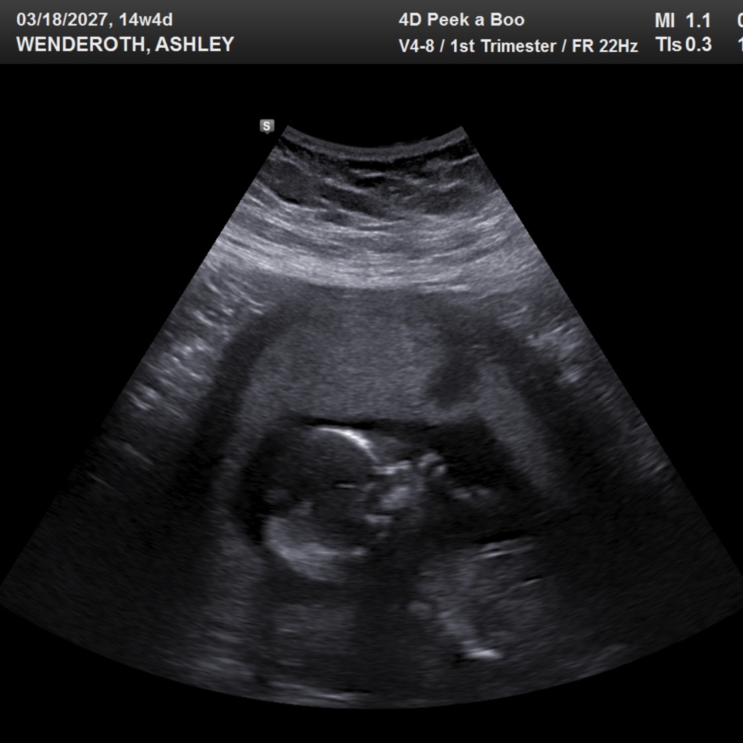 Photo shared by Ashley for their Babylist baby registry.