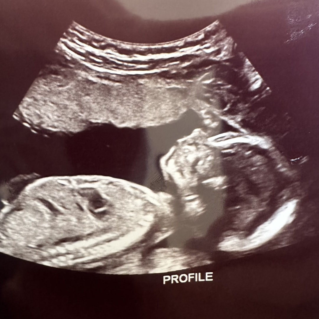 Photo shared by Paige for their Babylist baby registry.