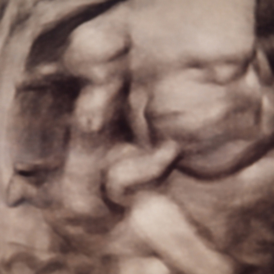 Photo shared by Rachael for their Babylist baby registry.