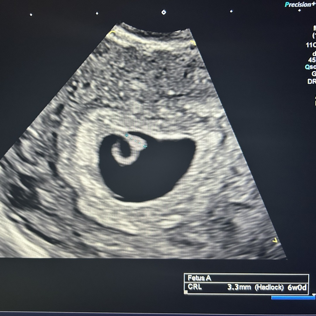 Photo shared by Ryleigh for their Babylist baby registry.