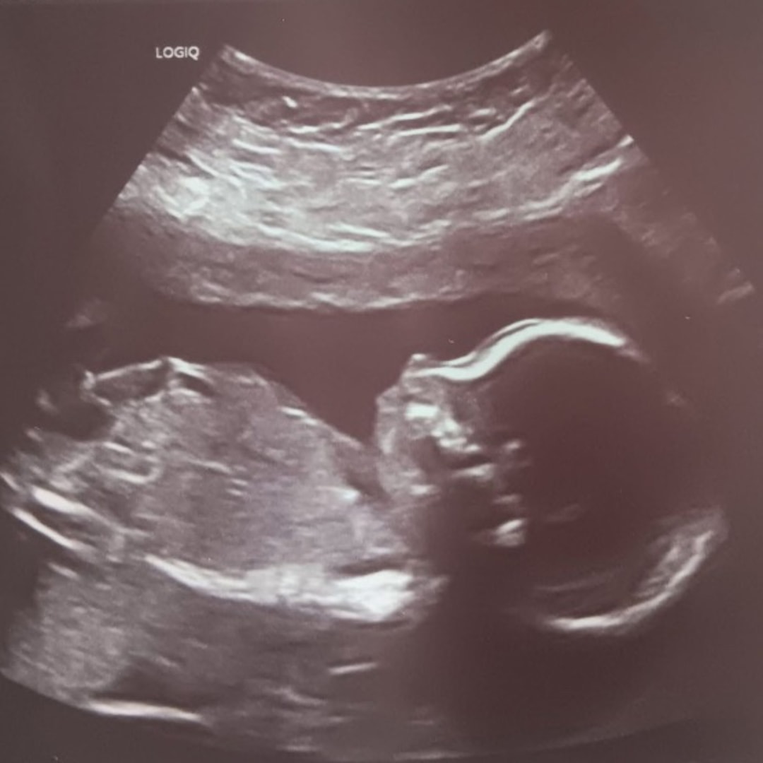 Photo shared by Lydia for their Babylist baby registry.