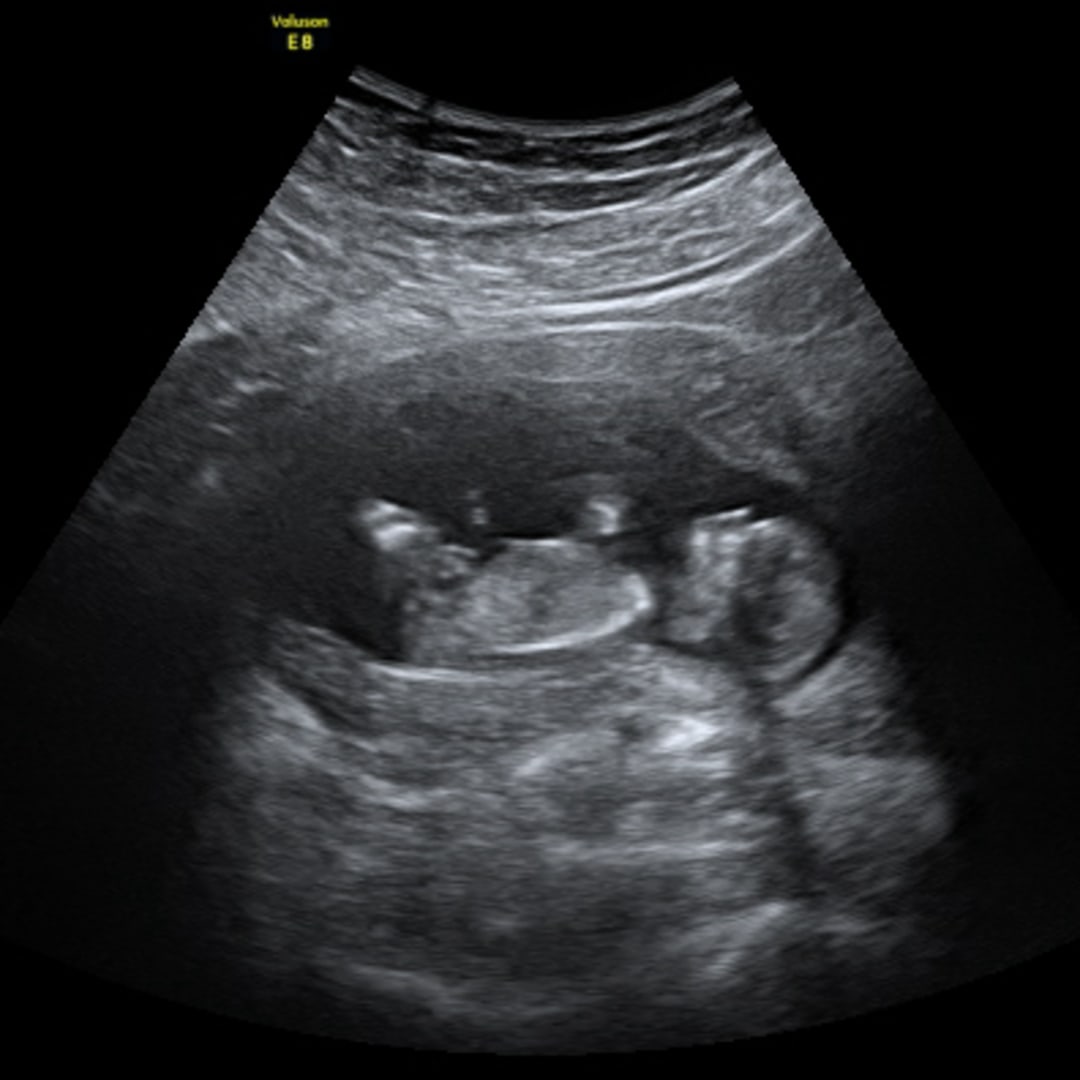 Photo shared by Kelby for their Babylist baby registry.