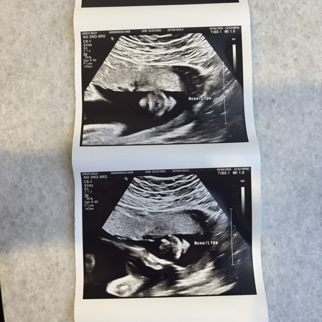 Photo shared by Riley for their Babylist baby registry.