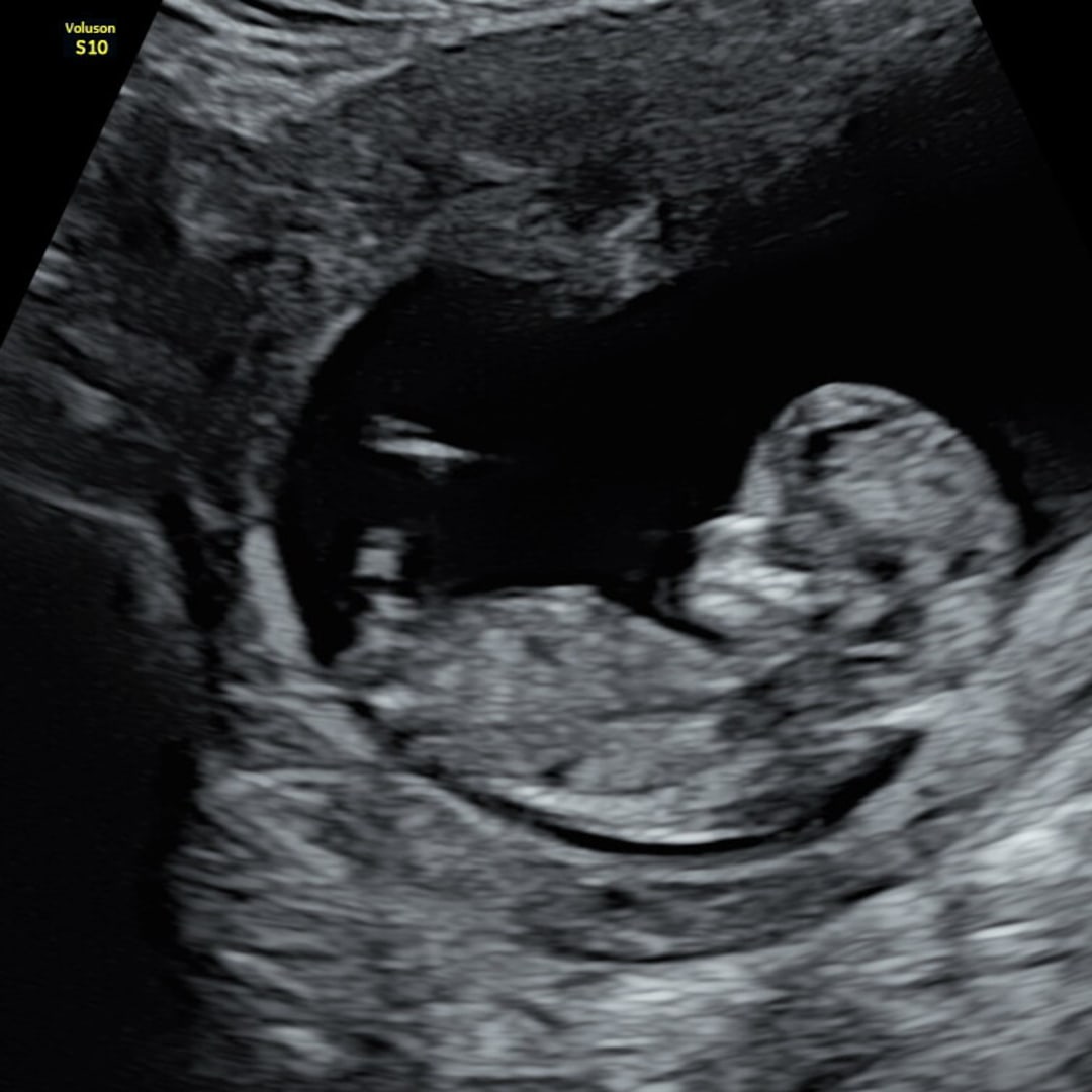 Photo shared by Hannah for their Babylist baby registry.