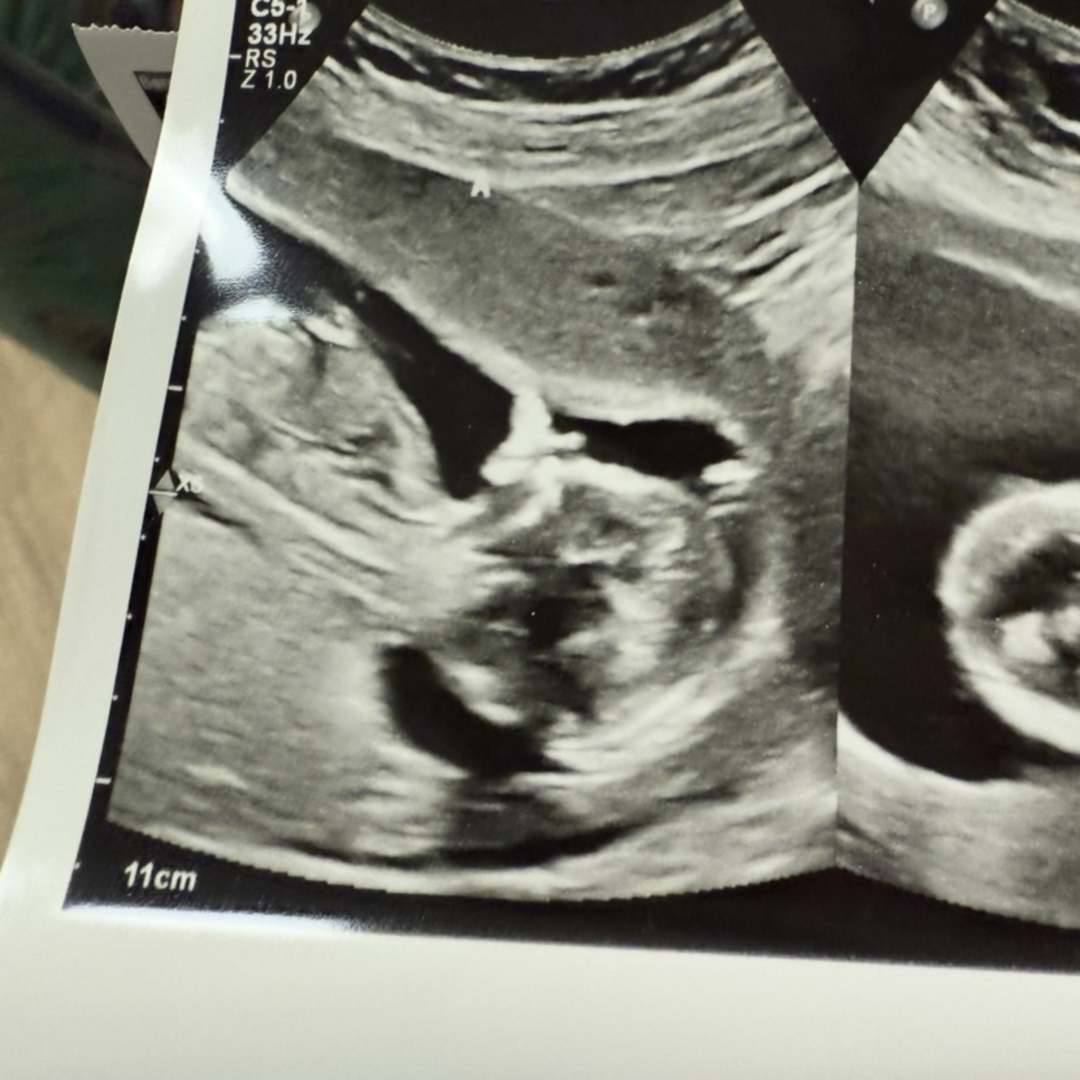 Photo shared by Mackenzie for their Babylist baby registry.