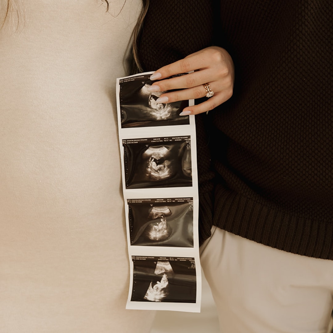 Photo shared by Bayleigh for their Babylist baby registry.