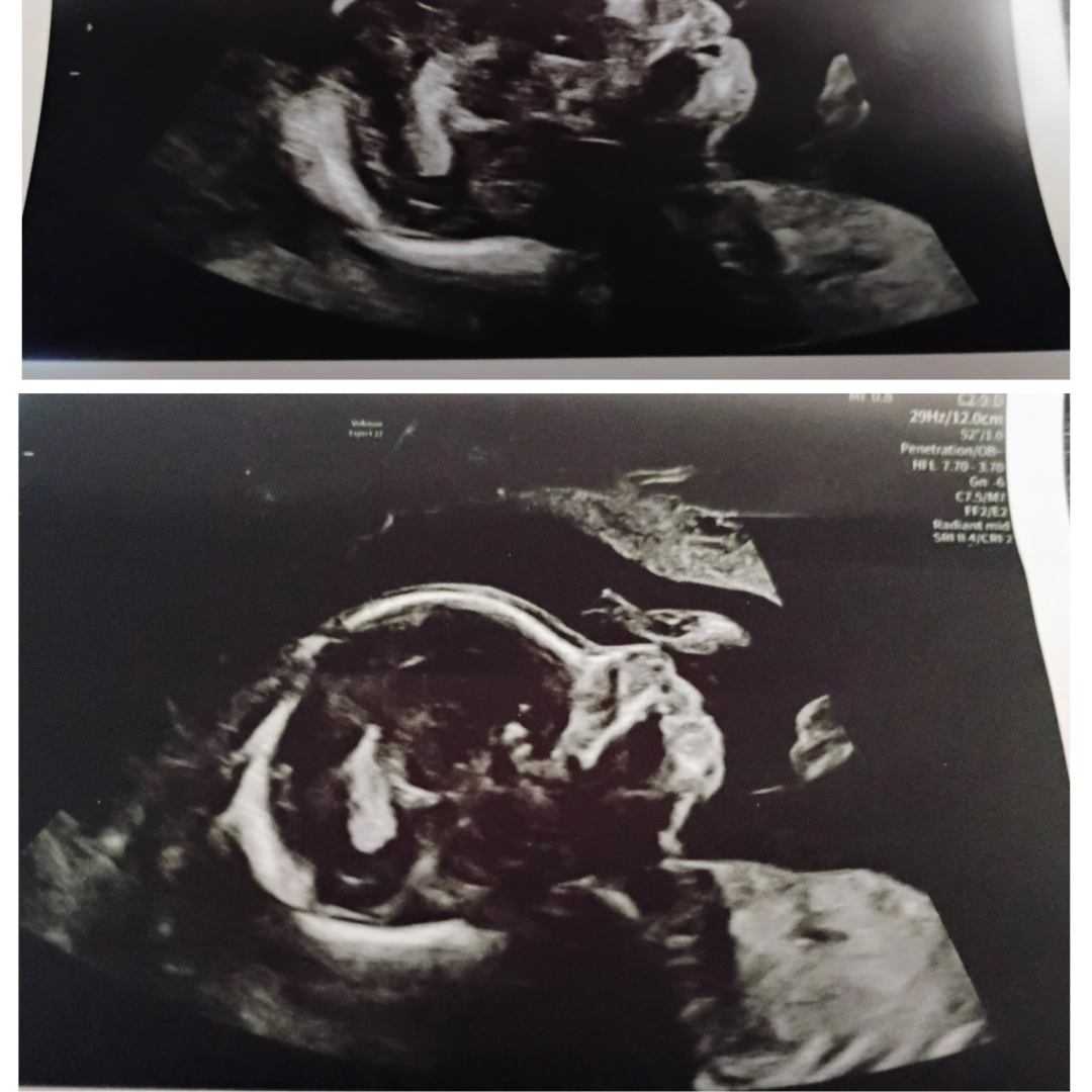 Photo shared by Janta for their Babylist baby registry.