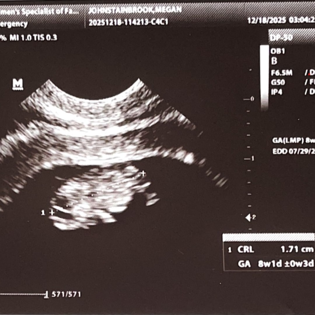 Photo shared by Megan for their Babylist baby registry.