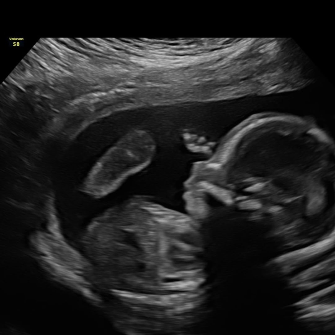 Photo shared by Micah for their Babylist baby registry.