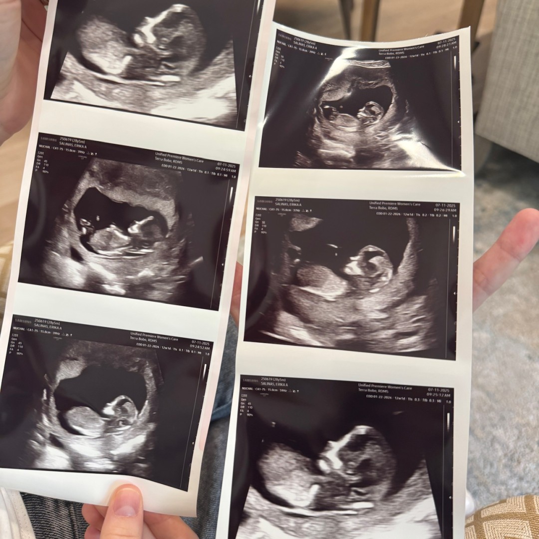 Photo shared by Erika for their Babylist baby registry.