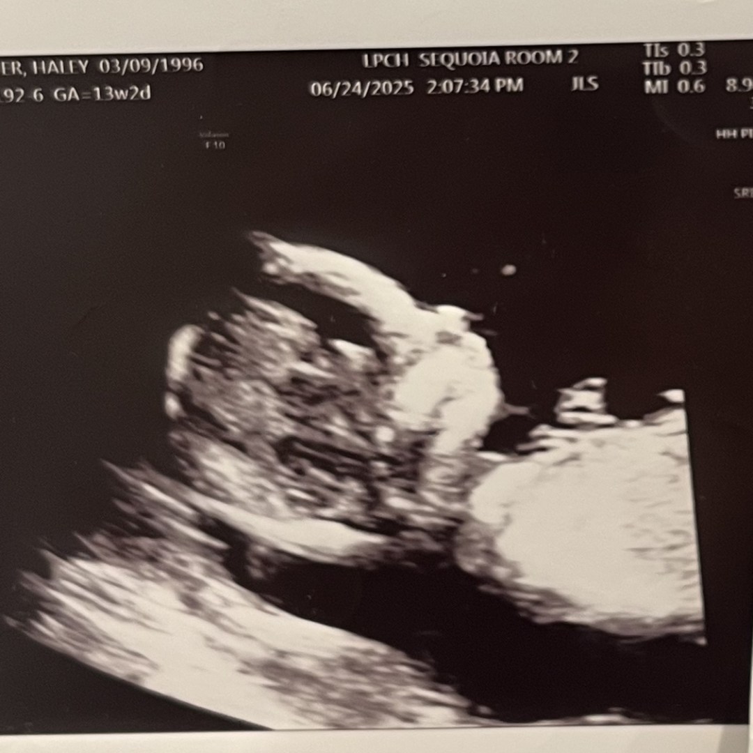 Photo shared by Haley for their Babylist baby registry.