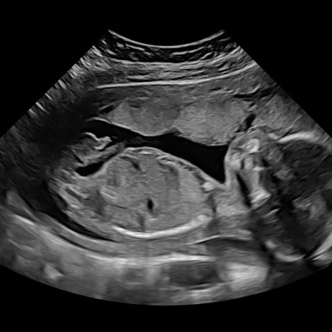 Photo shared by Cassidi for their Babylist baby registry.