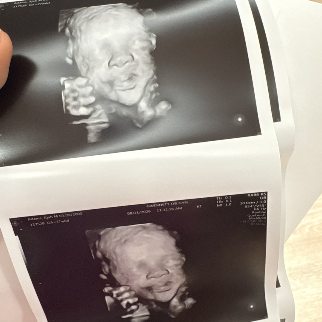 Photo shared by Cashy for their Babylist baby registry.