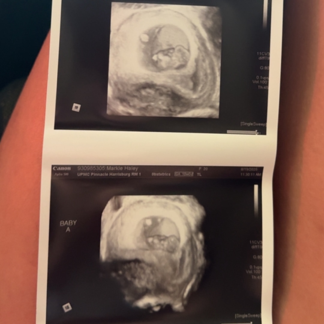 Photo shared by Haley for their Babylist baby registry.