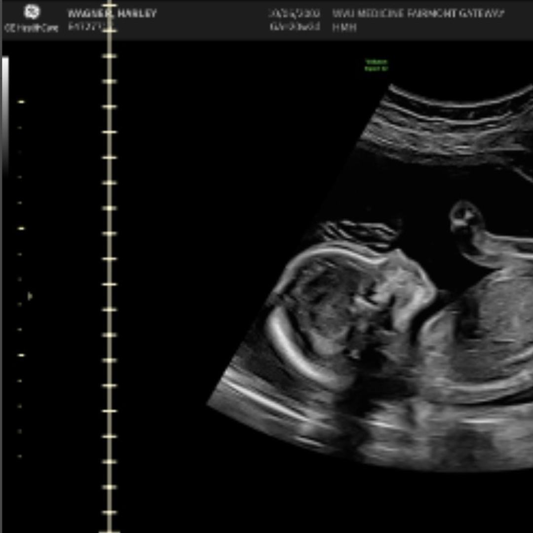 Photo shared by Harley for their Babylist baby registry.