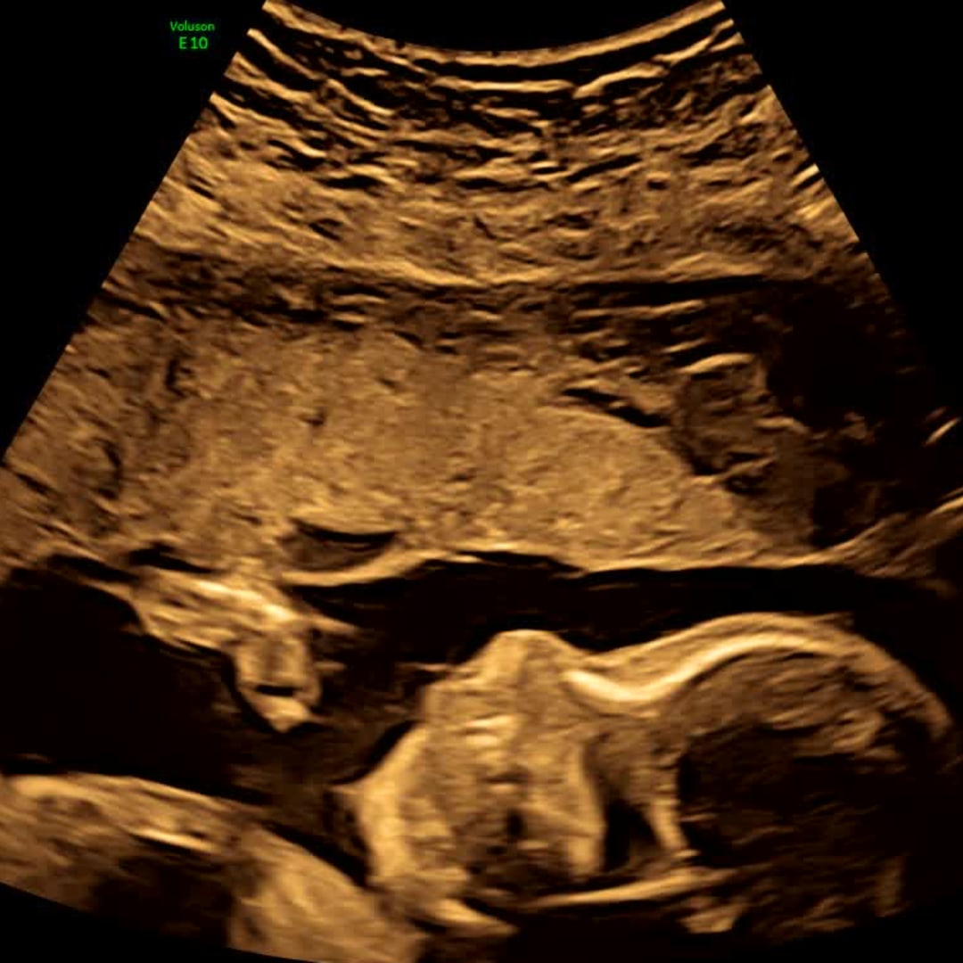 Photo shared by Iliana for their Babylist baby registry.