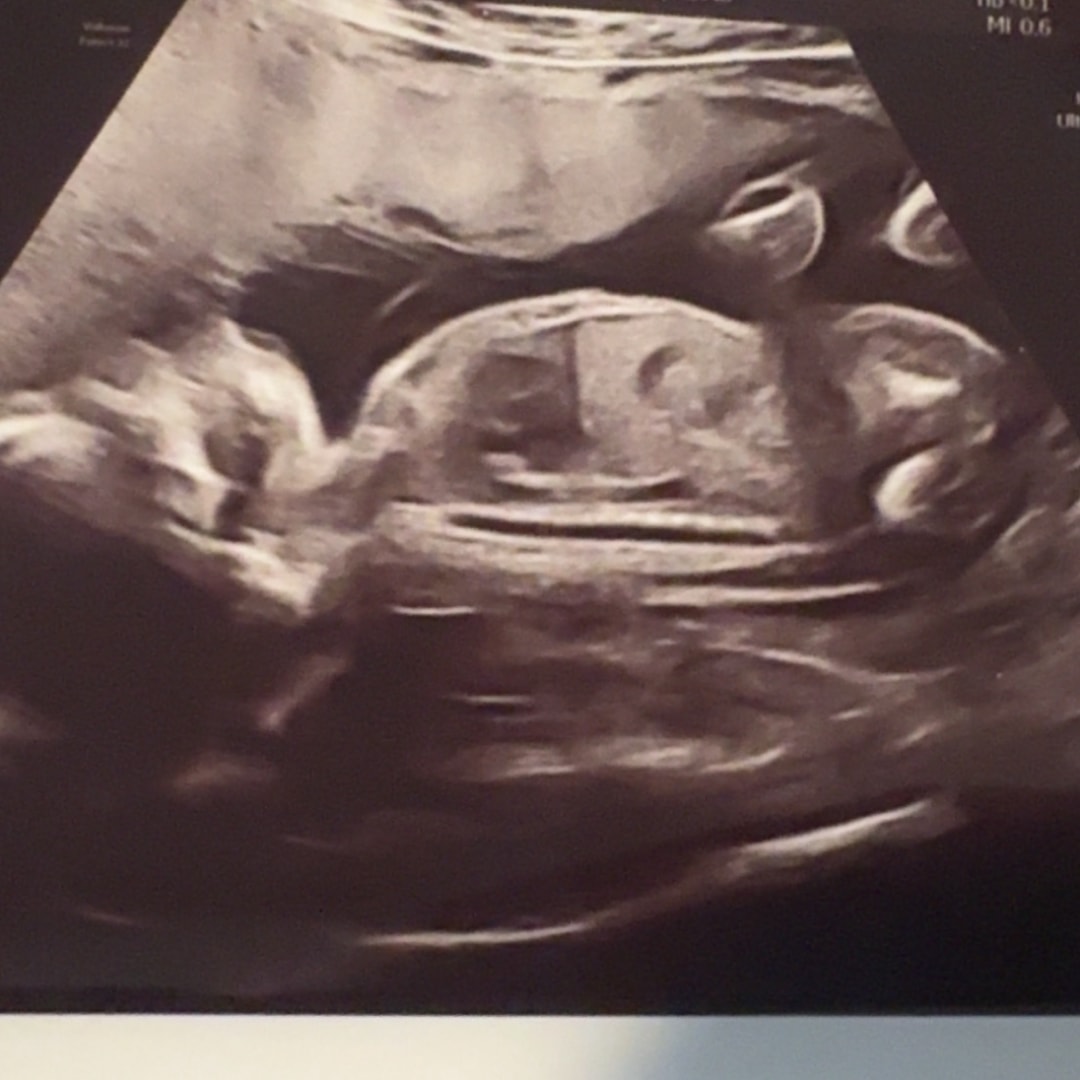 Photo shared by Amari for their Babylist baby registry.