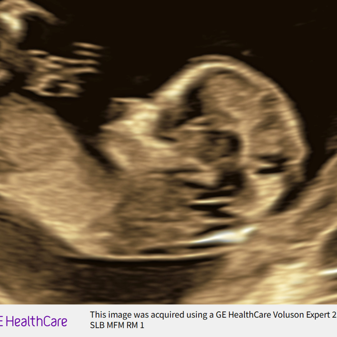 Photo shared by Knyla for their Babylist baby registry.