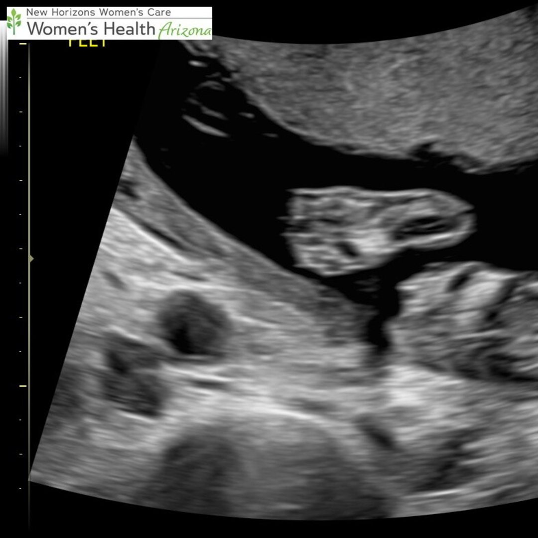 Photo shared by Ahnna for their Babylist baby registry.