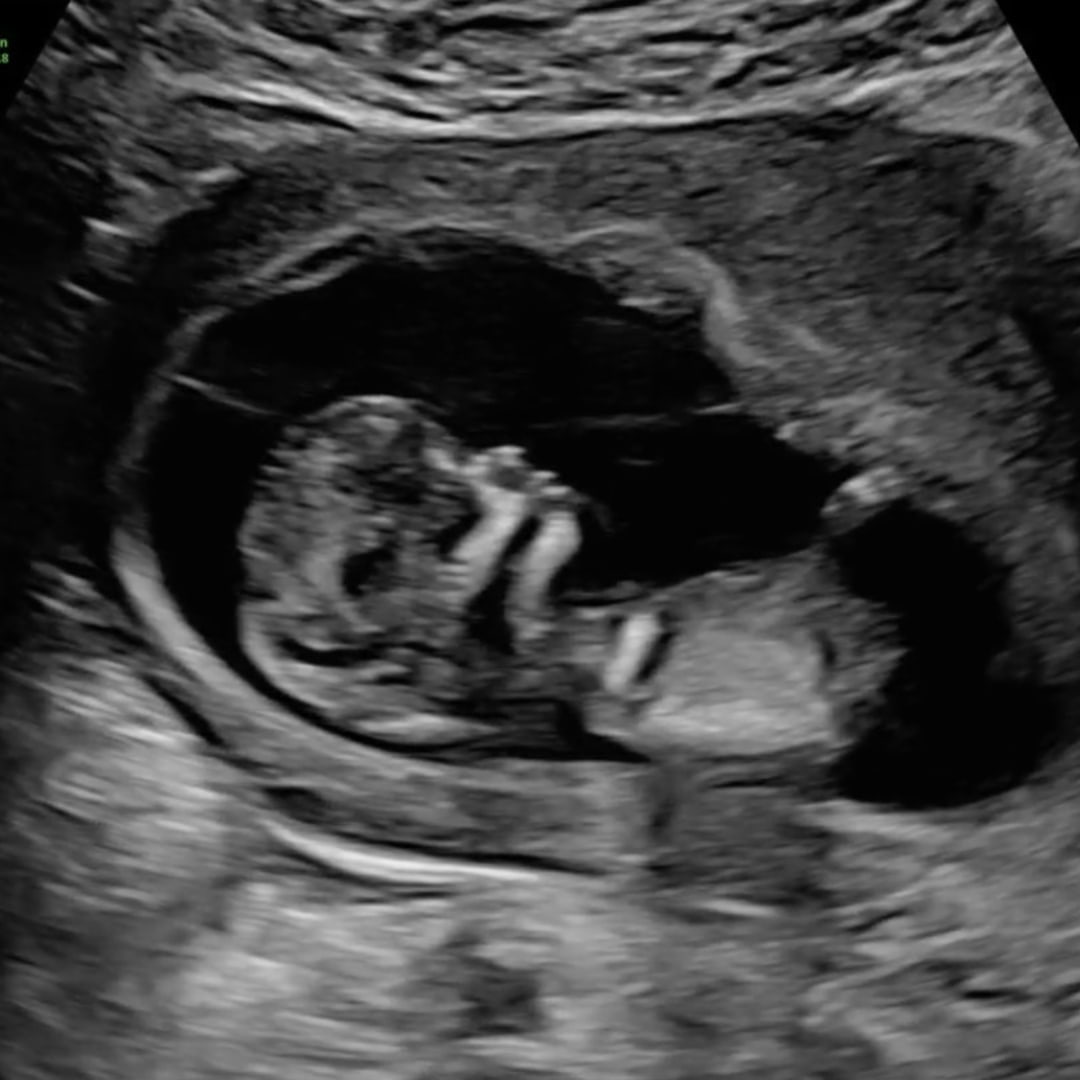 Photo shared by Deanna for their Babylist baby registry.
