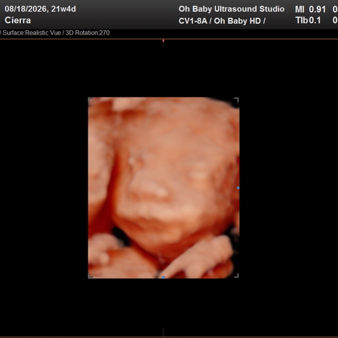 Photo shared by Cierra for their Babylist baby registry.