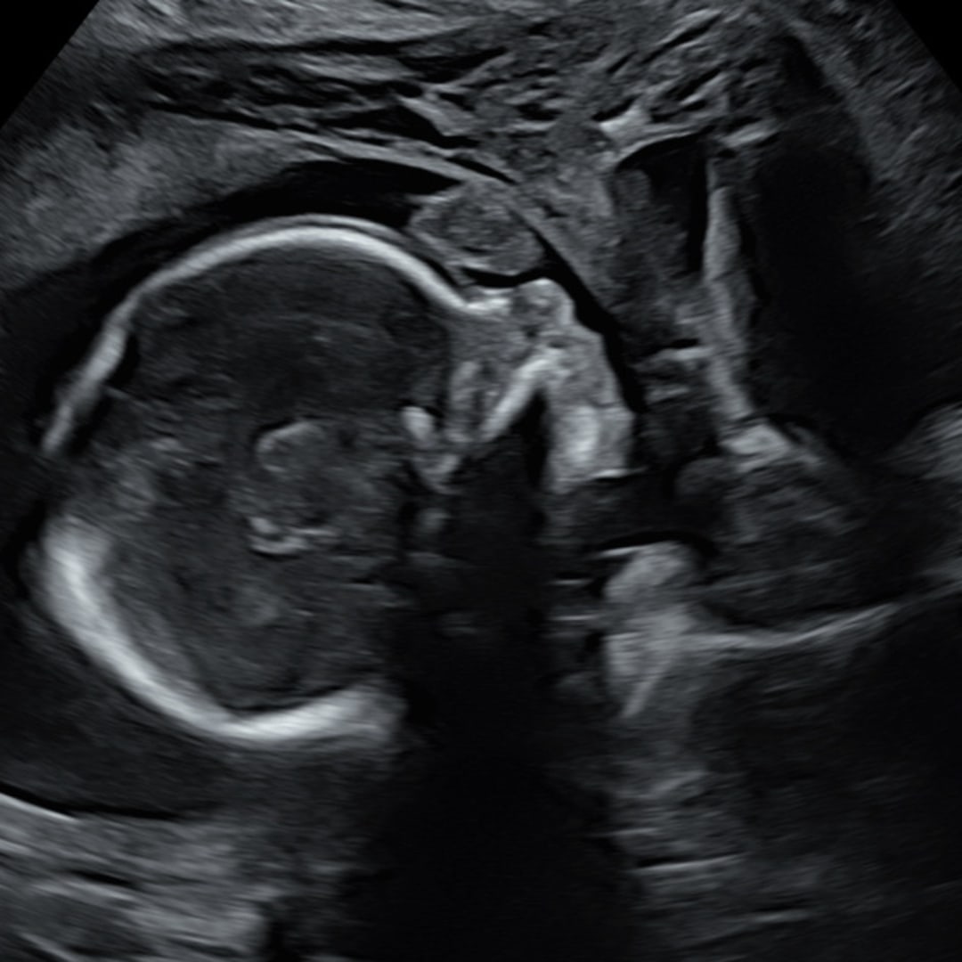Photo shared by Abigail for their Babylist baby registry.